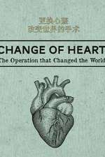 更换心脏：改变世界的手术
